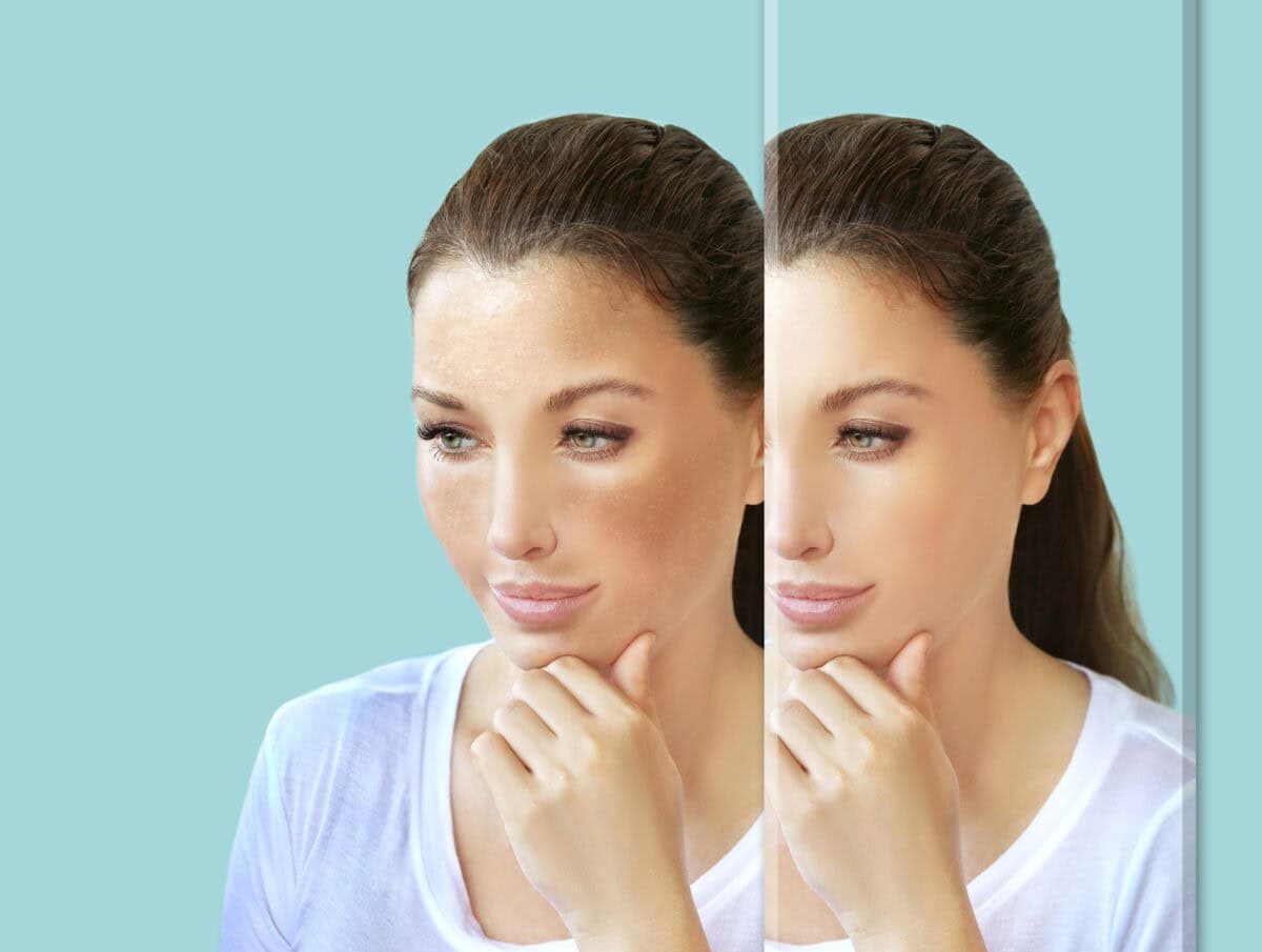 Are Image-Enhancing Drugs Addictive Glamour Or Hidden Danger?